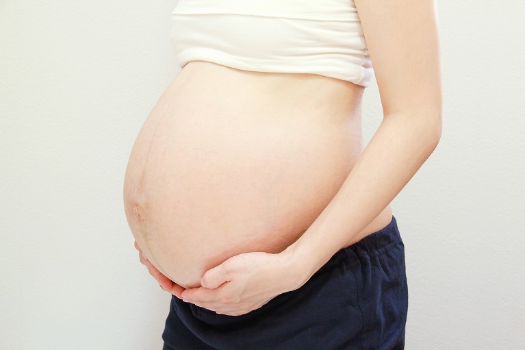 初産婦の計画分娩